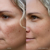 AHA Micro Exfoliator