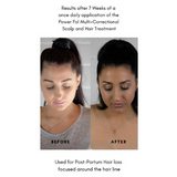 Power Fol - Advanced Multi-Correctional Lightweight Scalp & Hair Growth Treatment